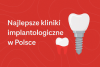Najlepsze kliniki implantologiczne w Polsce bikrisohoj